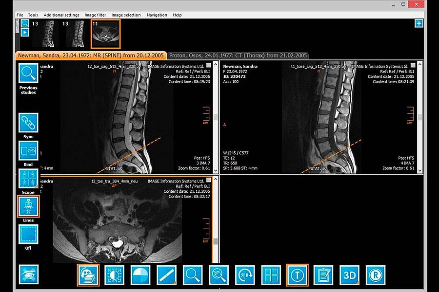 dicom méxico - Soluciones integrales en software de imagenología médica